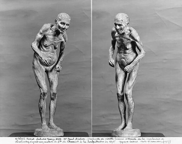 Statuette of an old woman with Parkinsons disease, after 1895 (plaster) (b  /  w photo)