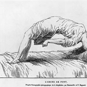 Hysteria and somnambulism, from Les Maladies Epidemiques de l Esprit
